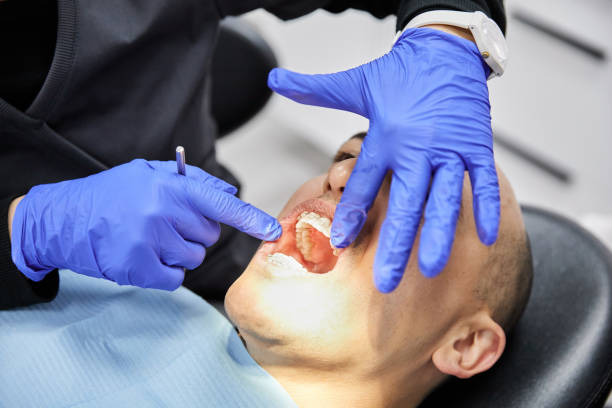 Dentist for Dental Trauma in TN