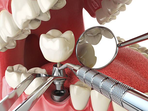 Best Cracked Tooth Emergency Dentist  in Clinton, TN